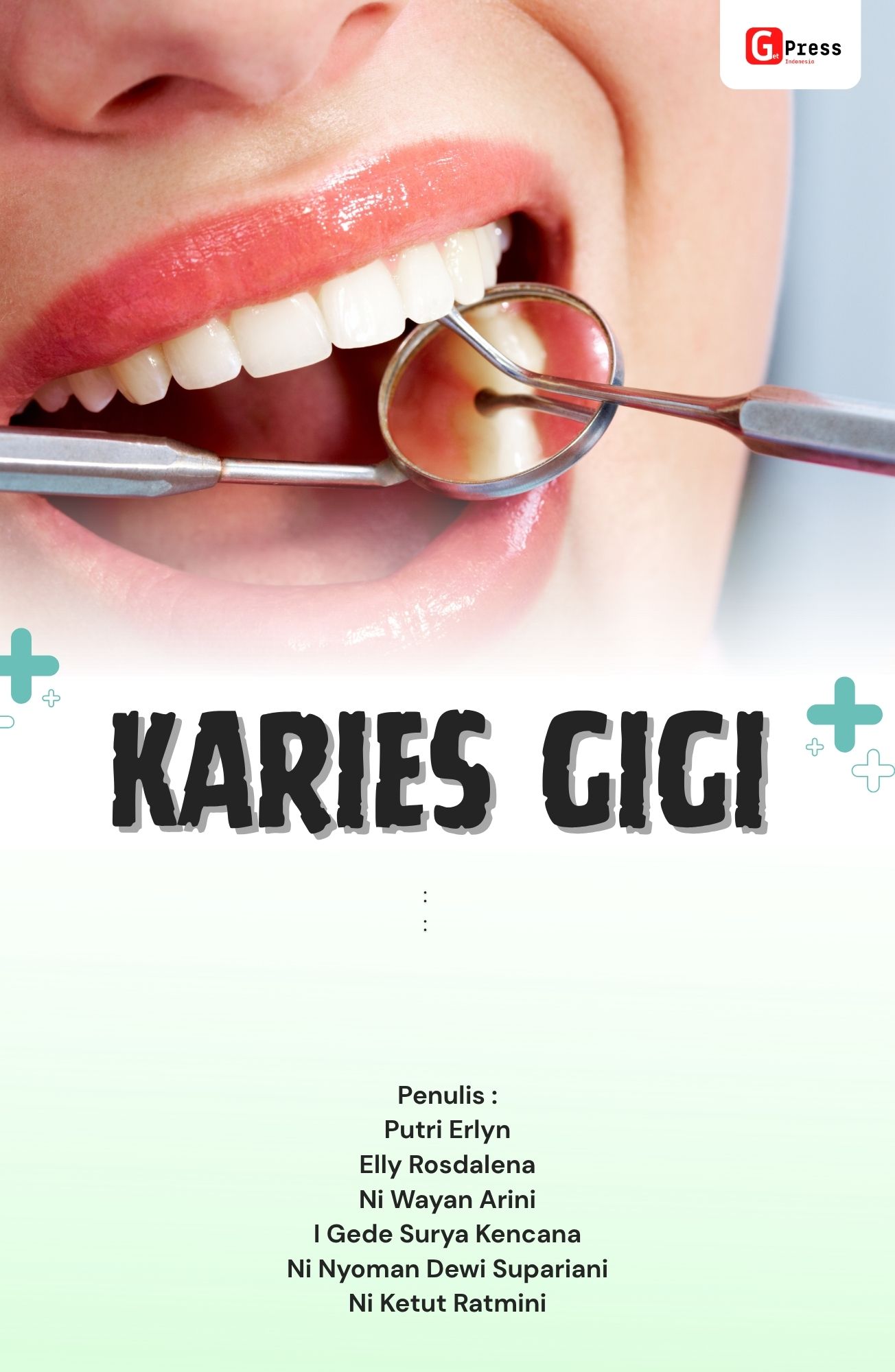 Karies Gigi